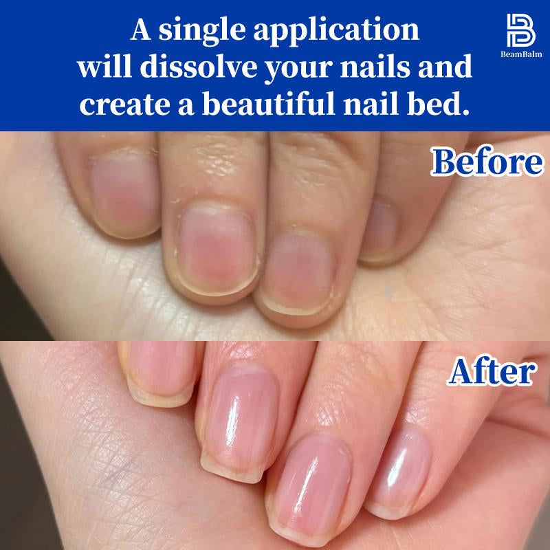 BEAMBALM Hyaluronic Acid Nail Hardener 11Ml - Dermatologist Tested Serum with Keratin & Bamboo Extract for Damaged Nails - Get Glassy Hard as Nails in 2 Weeks - Smooth Repair Manicure