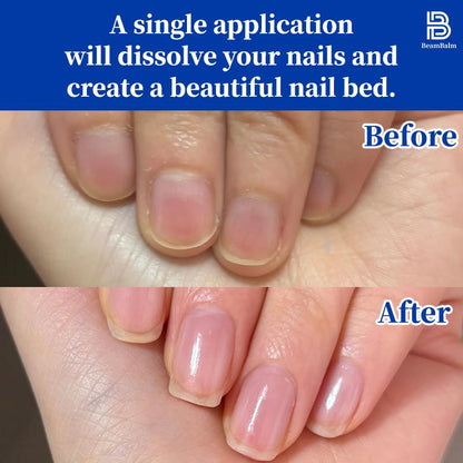 BEAMBALM Hyaluronic Acid Nail Hardener 11Ml - Dermatologist Tested Serum with Keratin & Bamboo Extract for Damaged Nails - Get Glassy Hard as Nails in 2 Weeks - Smooth Repair Manicure
